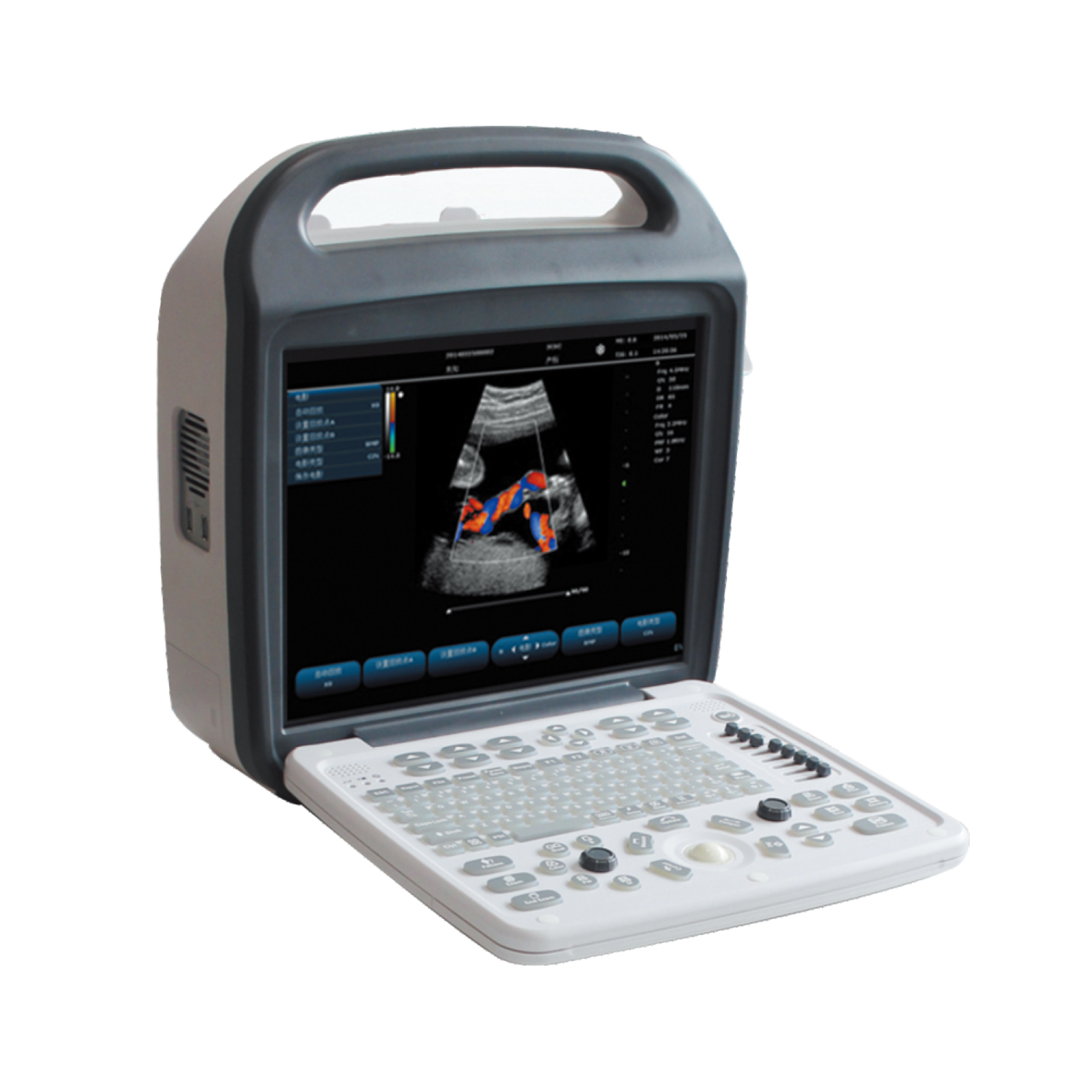 Сандық түсті доплерлік ультрадыбыстық диагностикалық аппарат KAI-A8